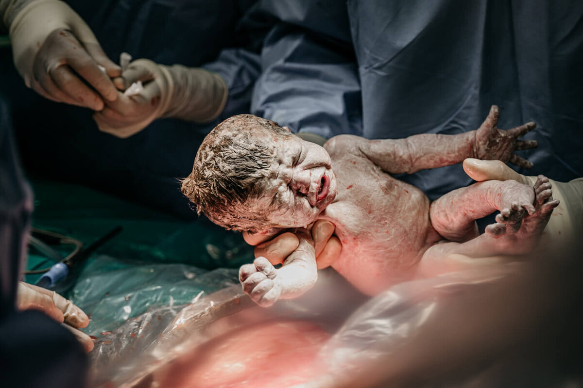 Geboortefotografie, geboorte, geboortefotograaf, bevalling, keizersnede 1 www.defotokundige.nl-4