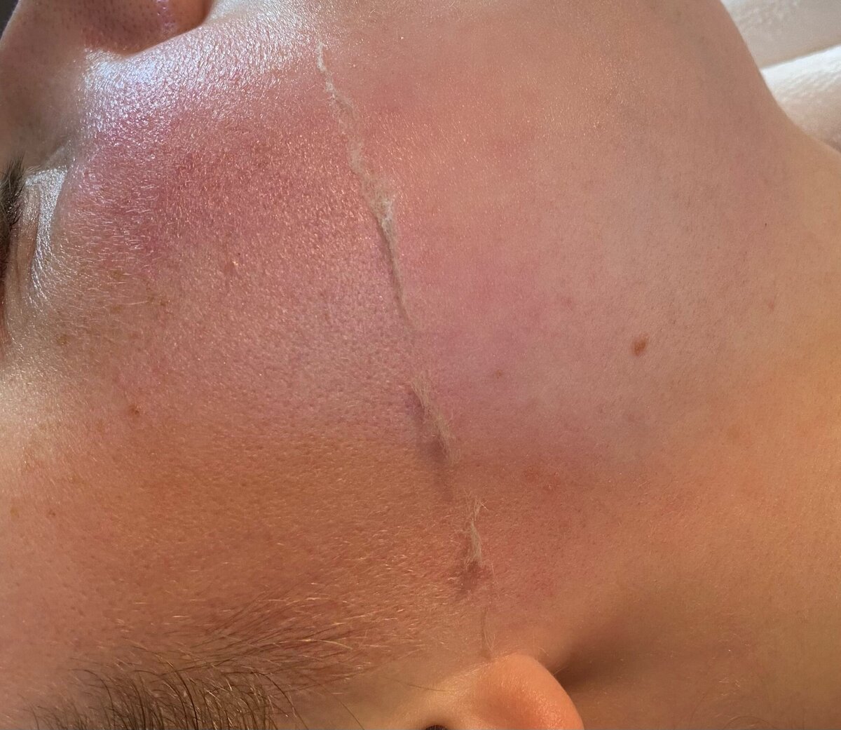 skin12