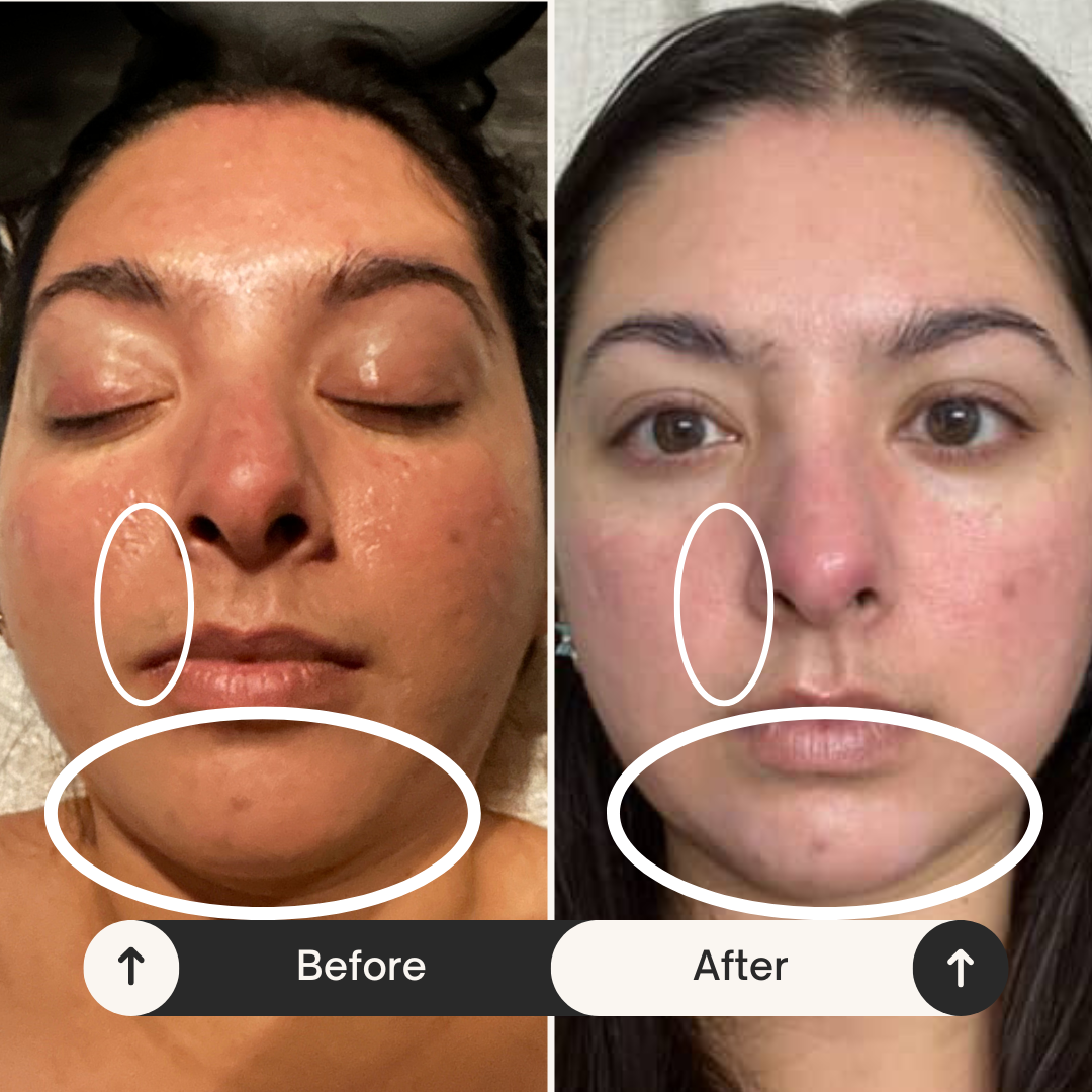 Buccal before after 3