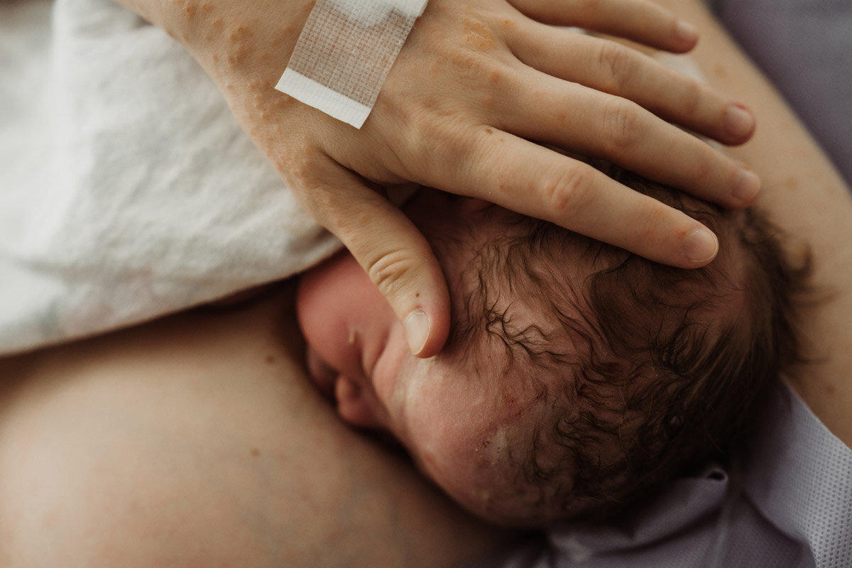 cesarean-birth-photography-natalie-broders-c-044