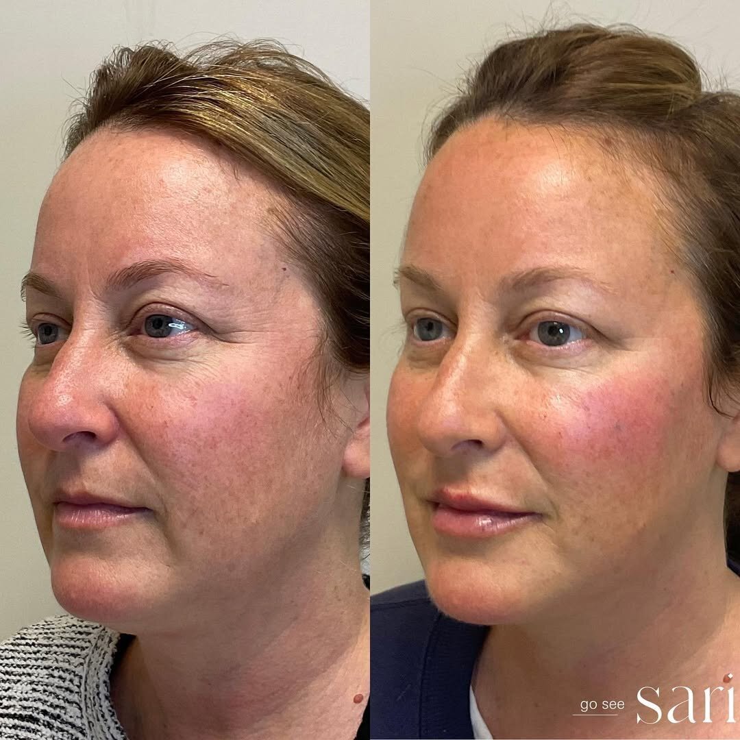 Facial Balancing 1_Go See Sari