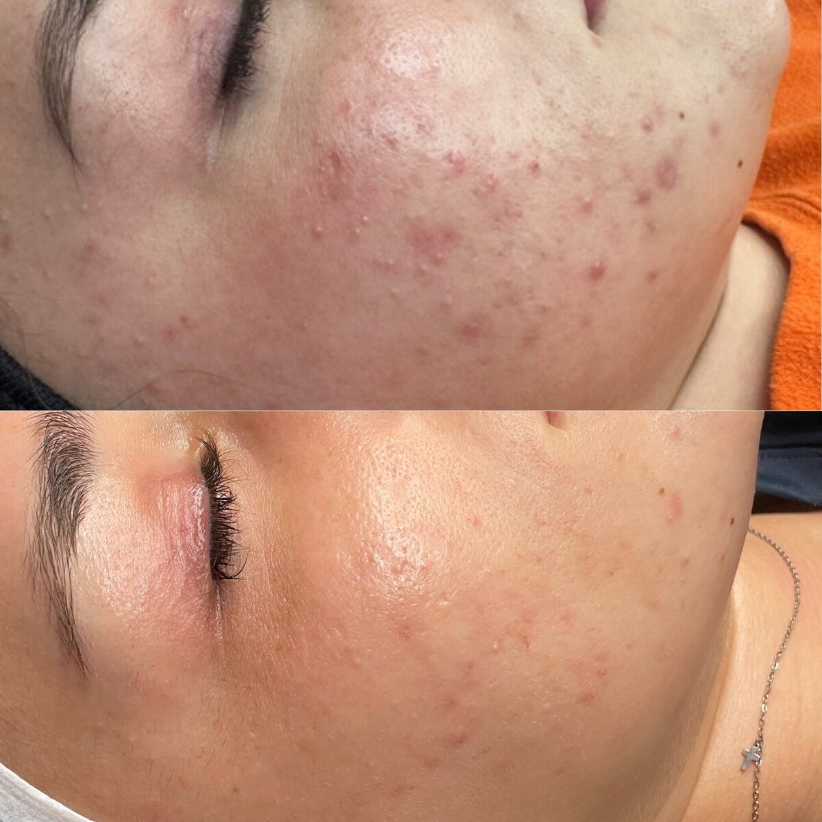 F4184148-50CF-429E-973D-099E684E154C_L0_001-8_3_2024, 12_39_54 PM