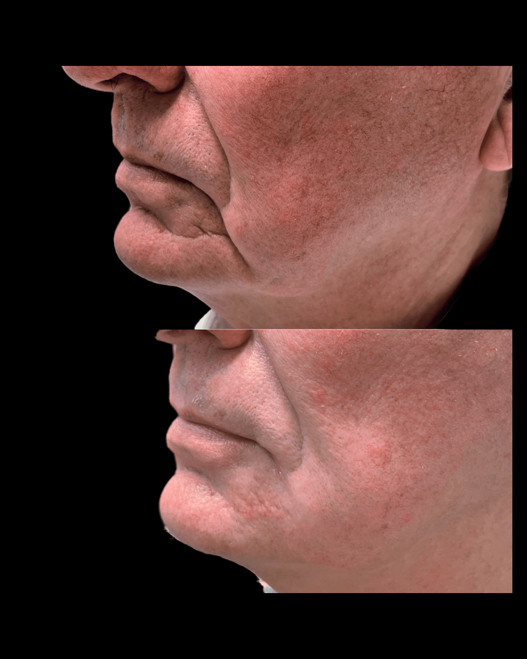 Maxwell-Aesthetics-Salem-Oregon-Results-33