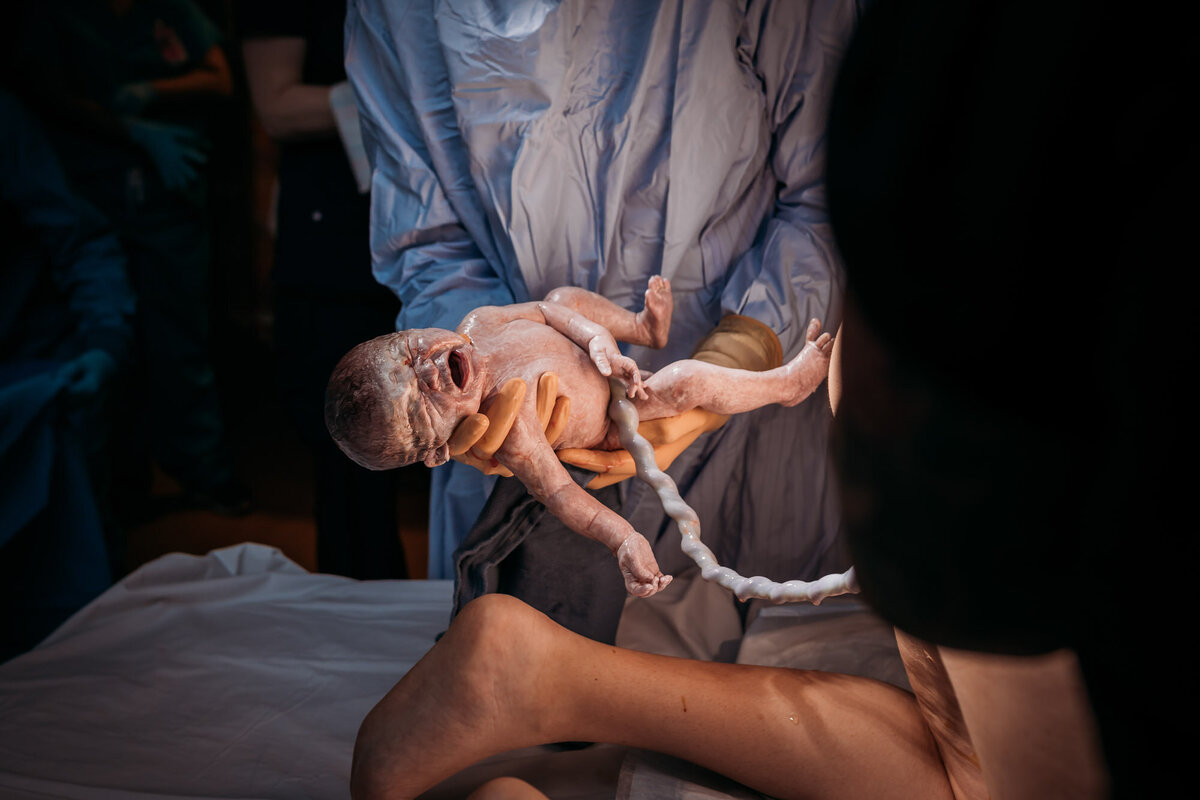 doctor holding newborn with umbilical cord