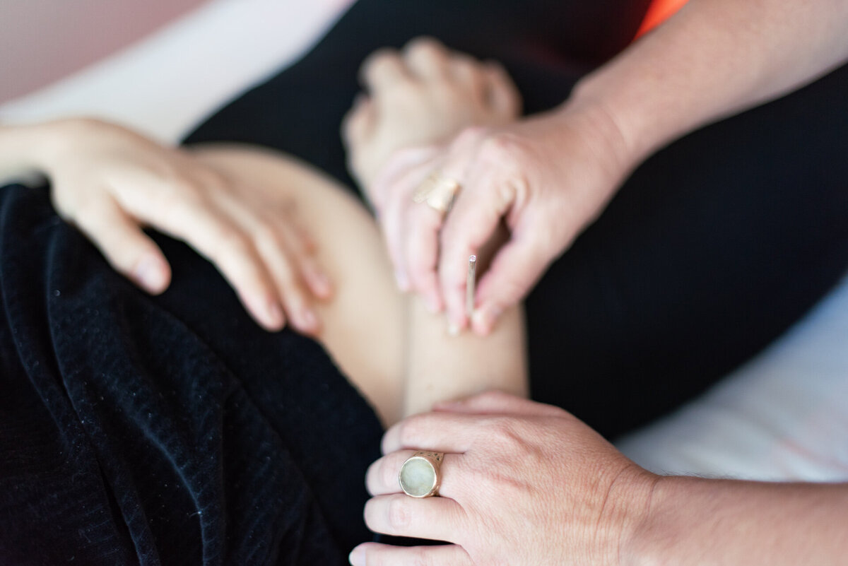 Lacey_Dupre_Needle_free_Acupuncture_1