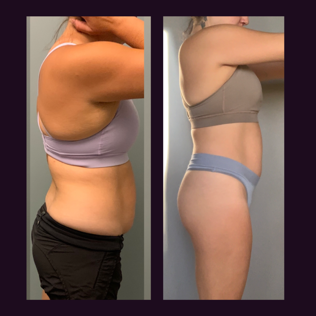 Transformation comparisons (1)