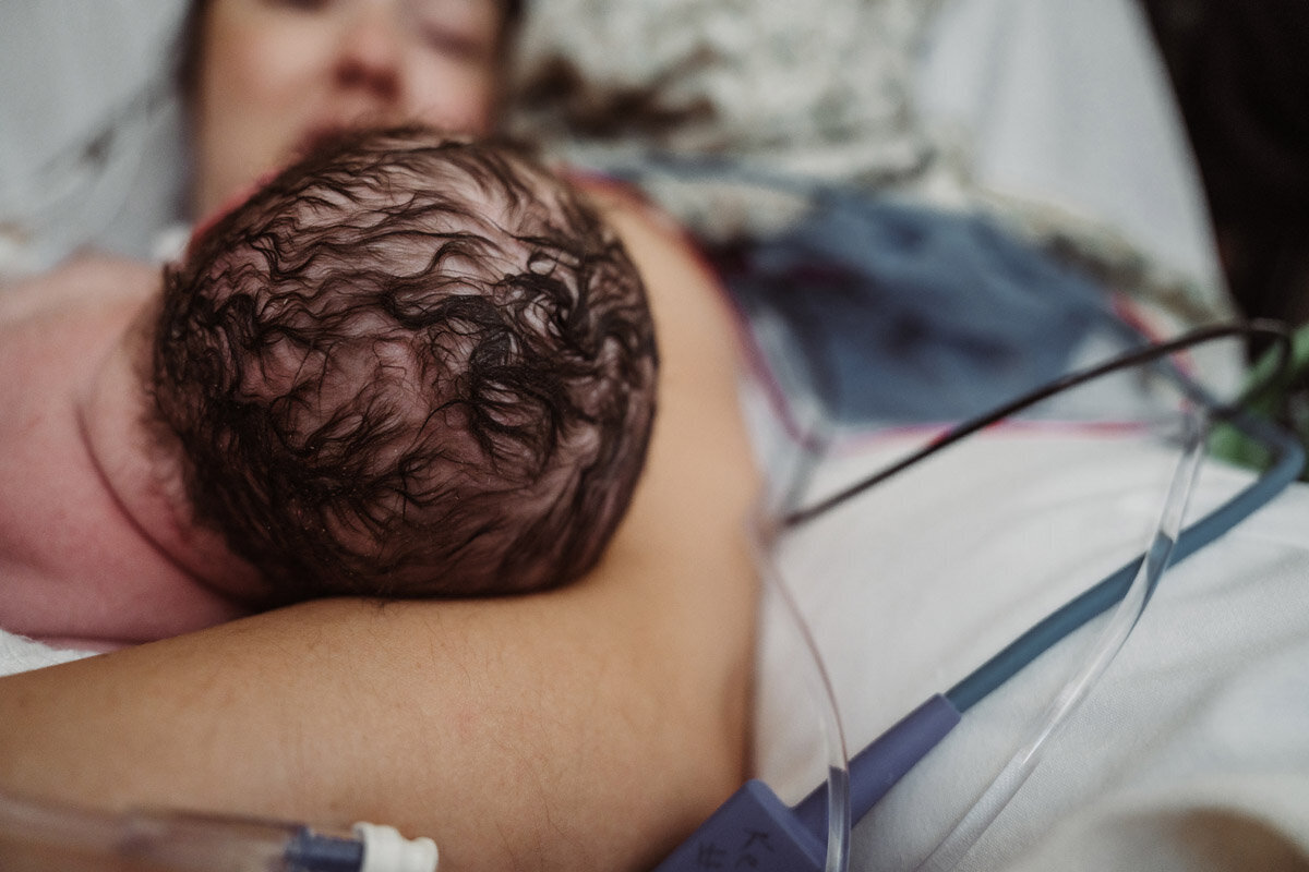 cesarean-birth-photography-natalie-broders-d-105
