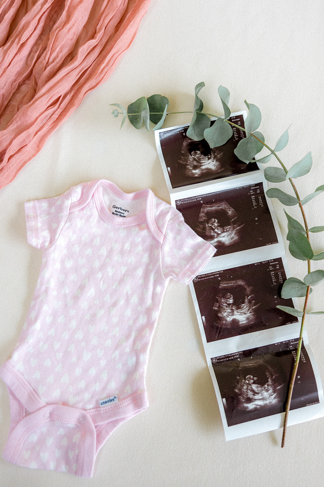 Sonogram & pink baby onesie