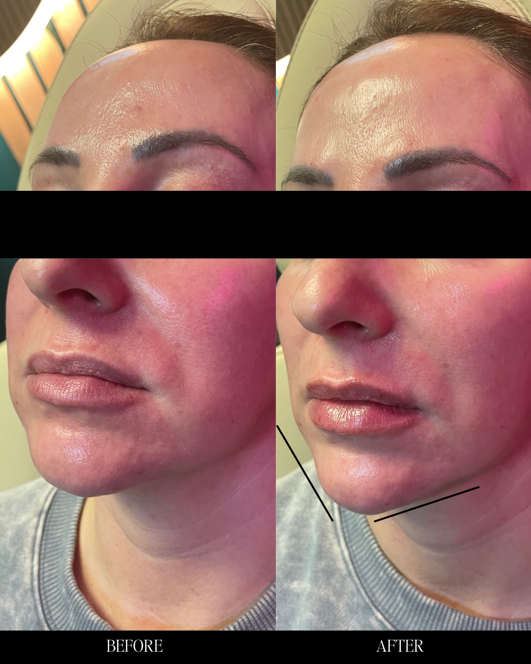 Copy of Before and Afters (Portrait Size).png 2