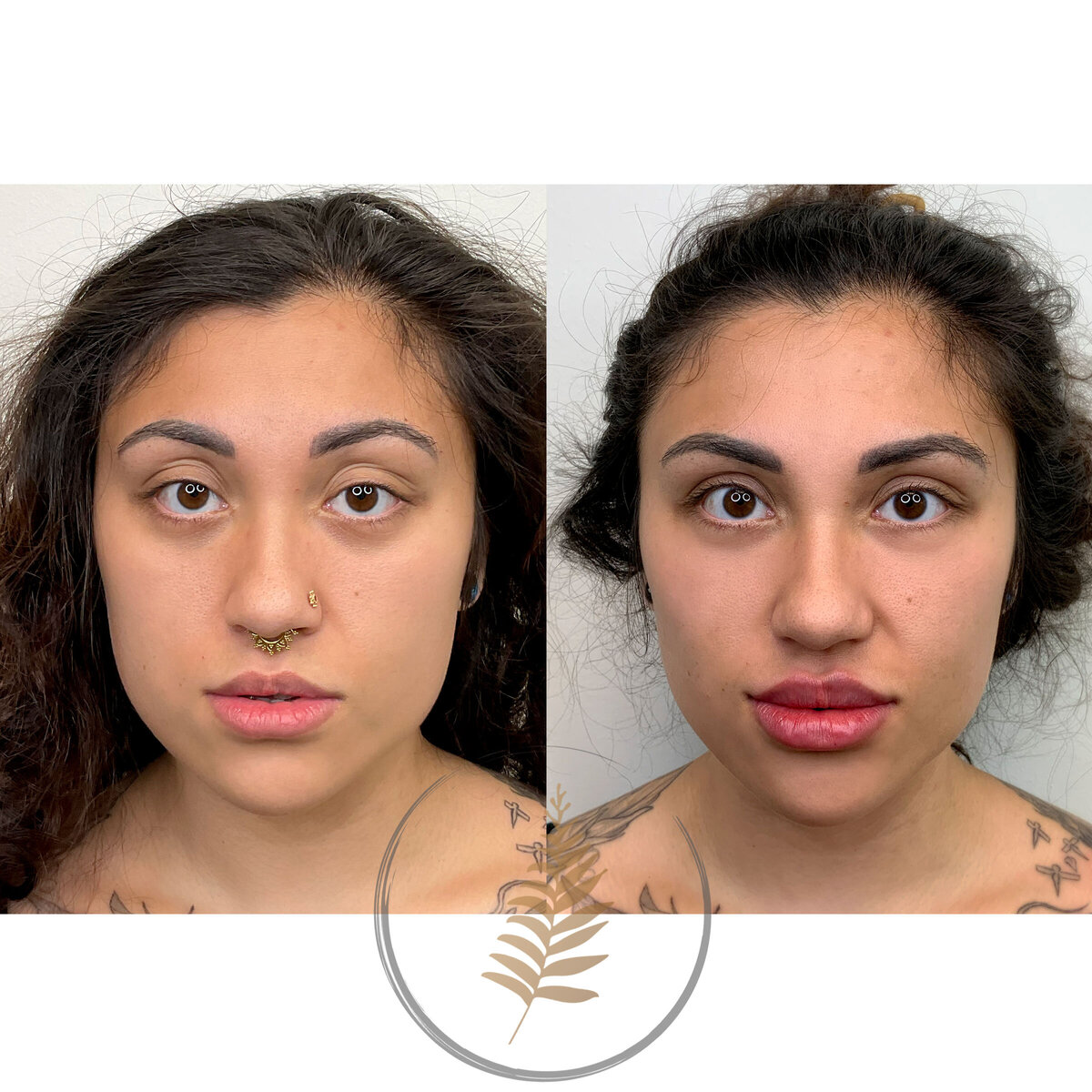 FACESINBLOOM_BEFOREAFTER_LIPS_13