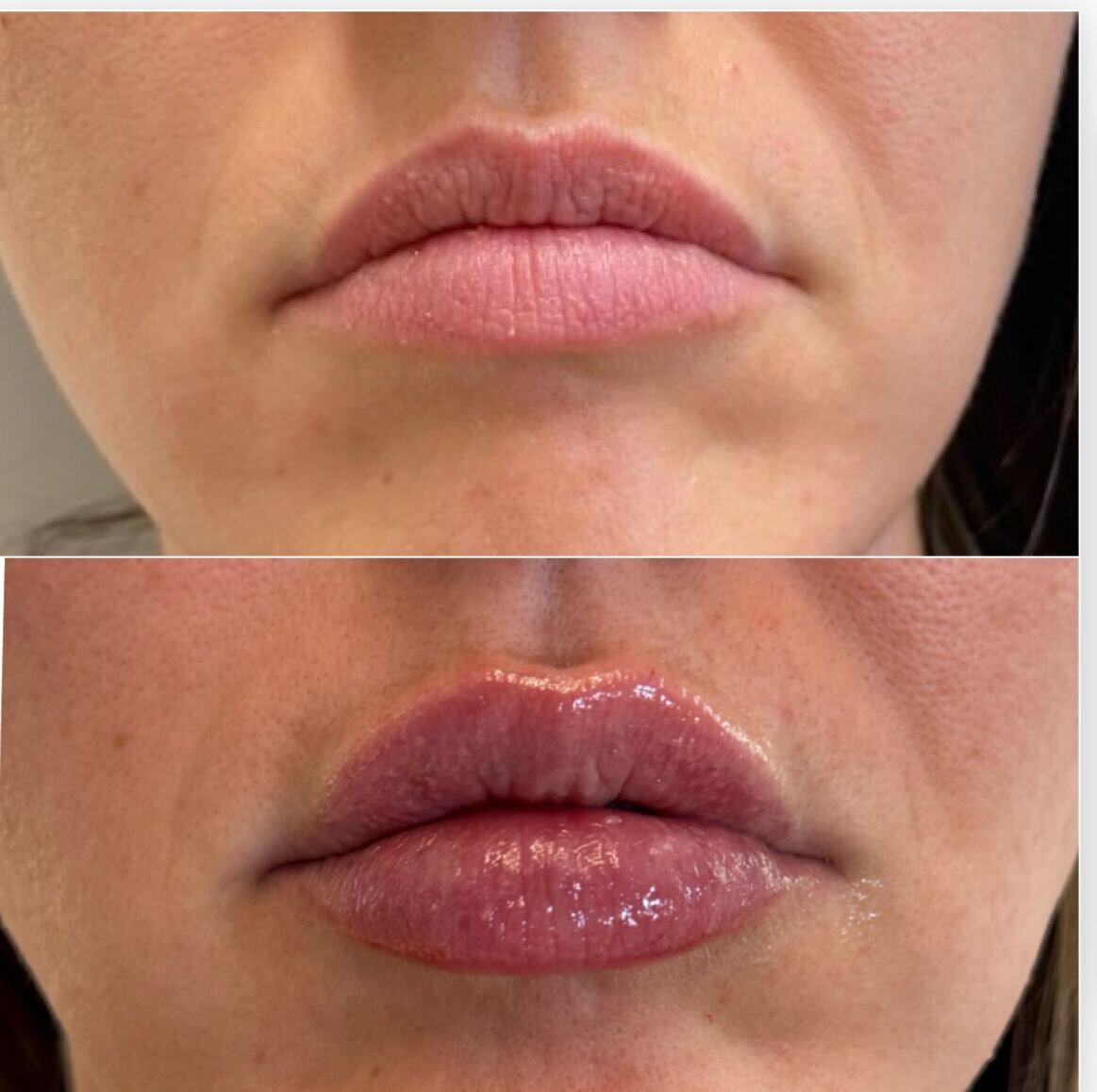 compressed-Lip-Wrinkles- Lip-volume-nd-some-brand-pics-24