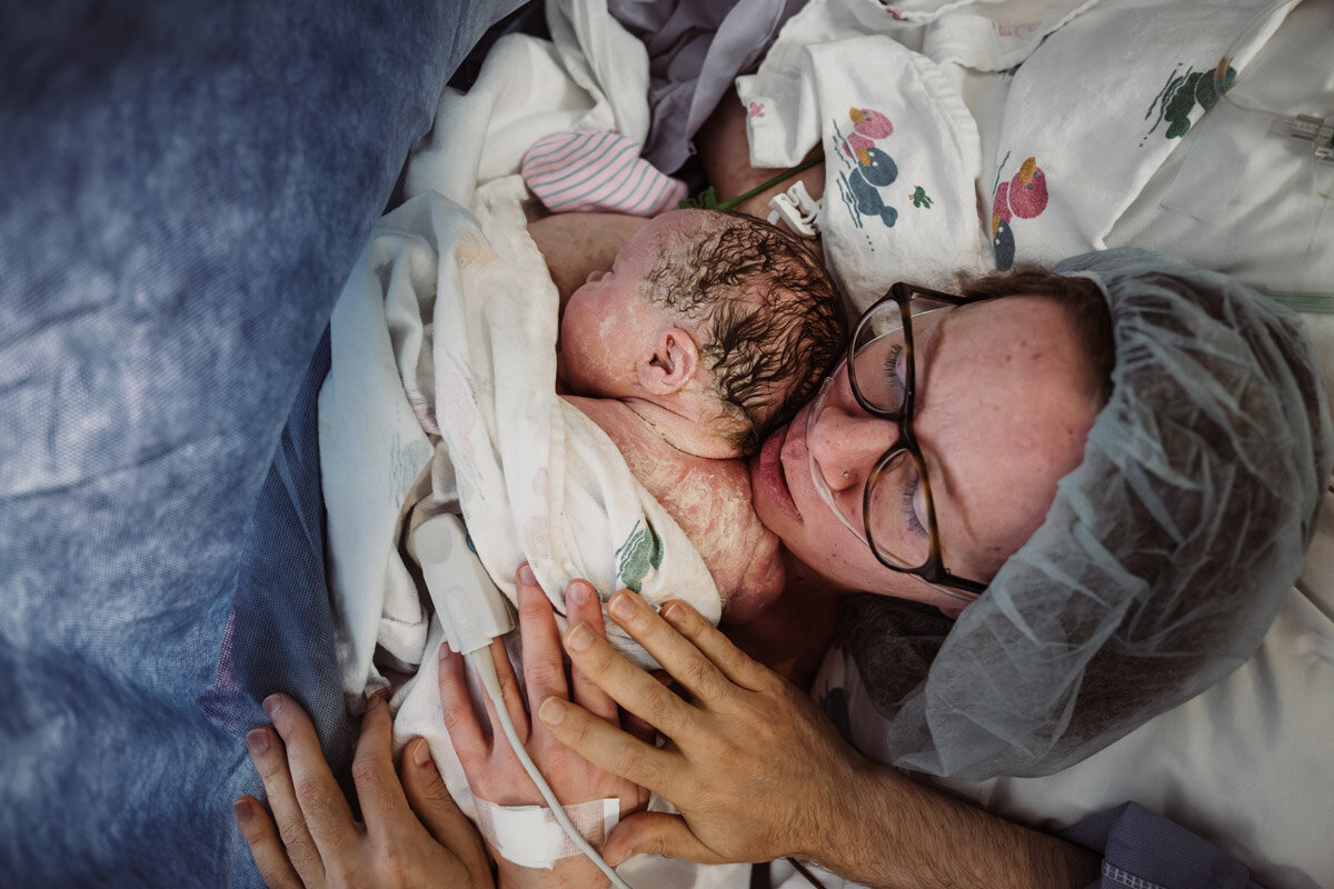 cesarean-birth-photography-natalie-broders-c-030