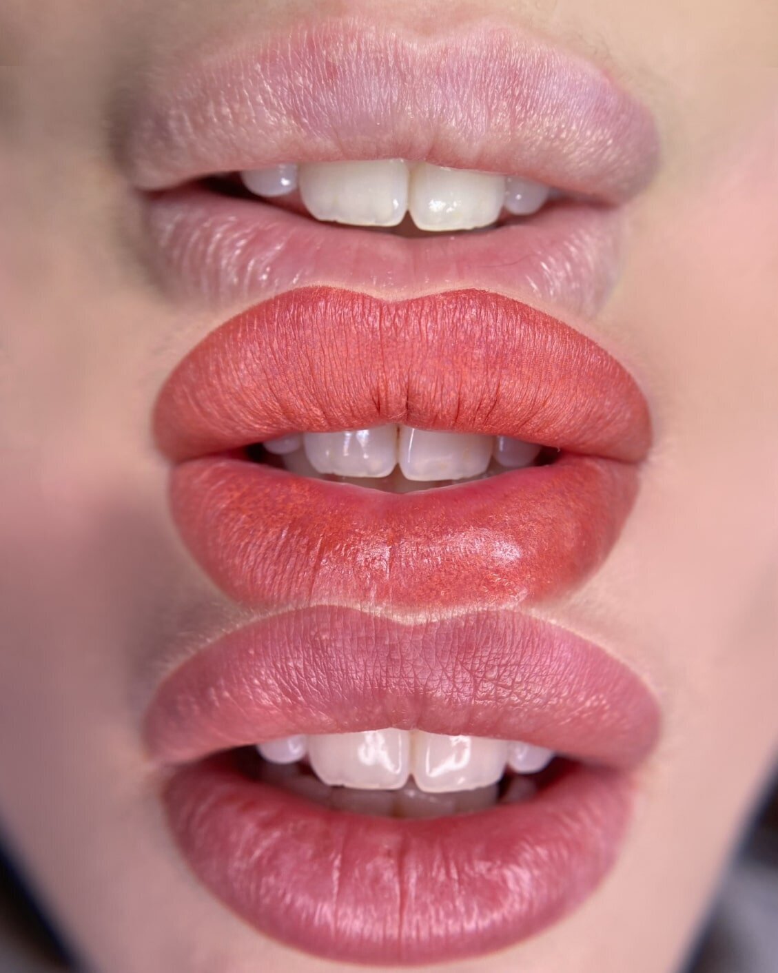 pmu-lips-elysian