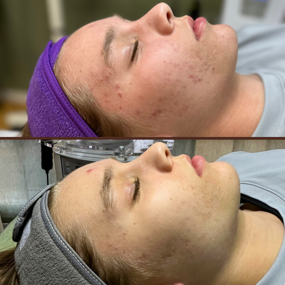 Kendall B & A Bootcamp - 1