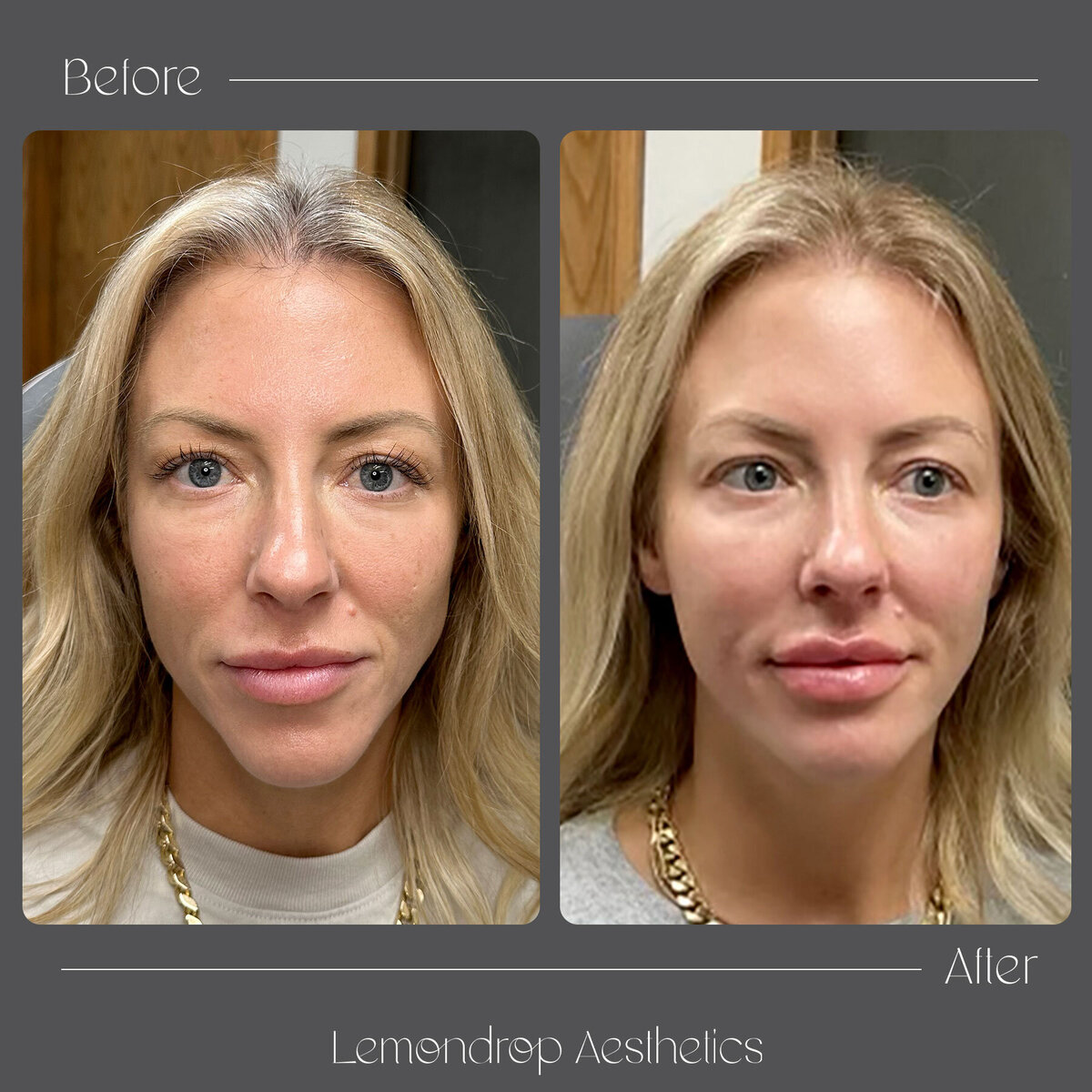 BEFORE-AFTER