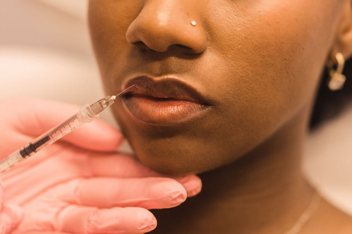 woman receiving a cosmetic injection in her lips