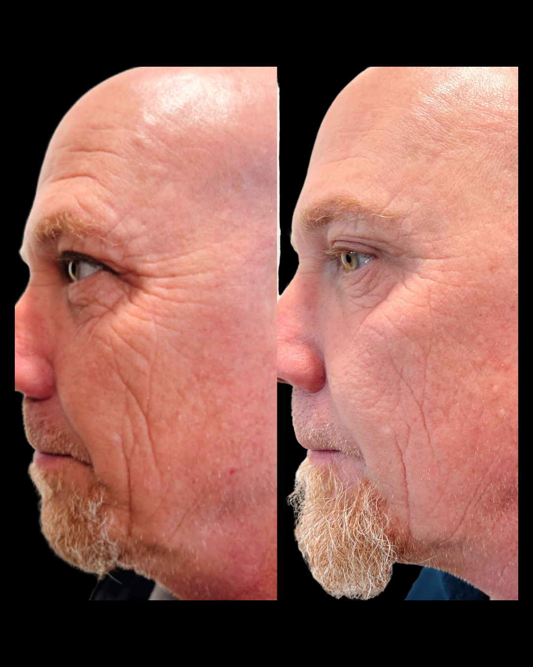 Maxwell-Aesthetics-Client-Results-Salem-21