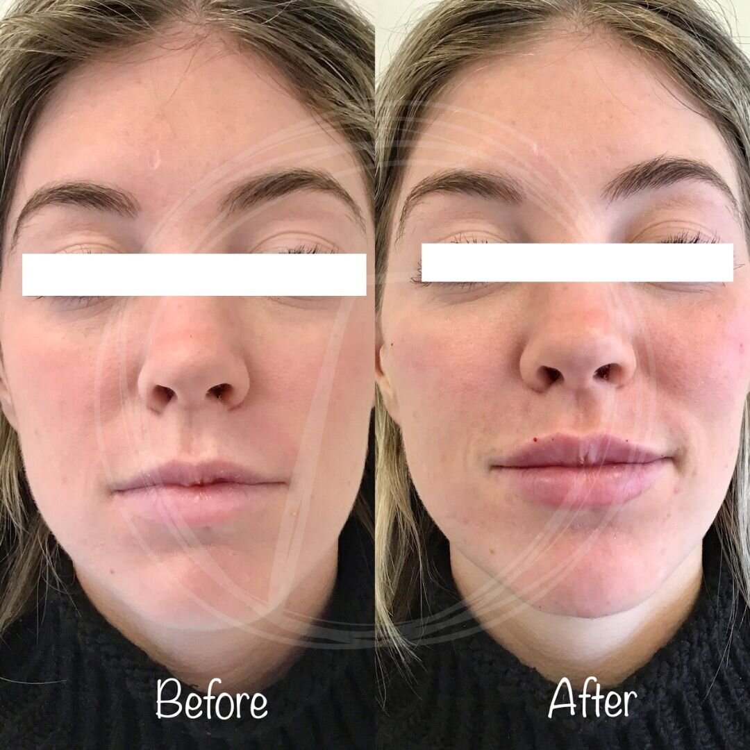 before:after results with look timeless - 8