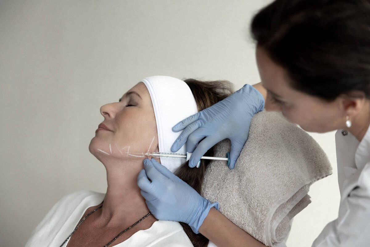 Fillers door drs Lizenka Adriaanse cosmetisch arts Rotterdam