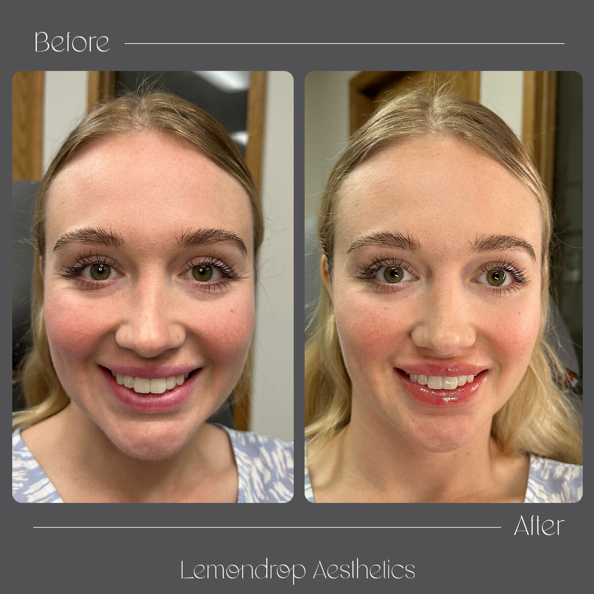 BEFORE-AFTER copy 7