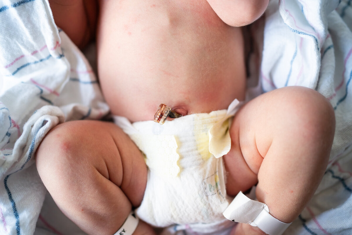 Newborn baby belly with umbilical cord and diaper