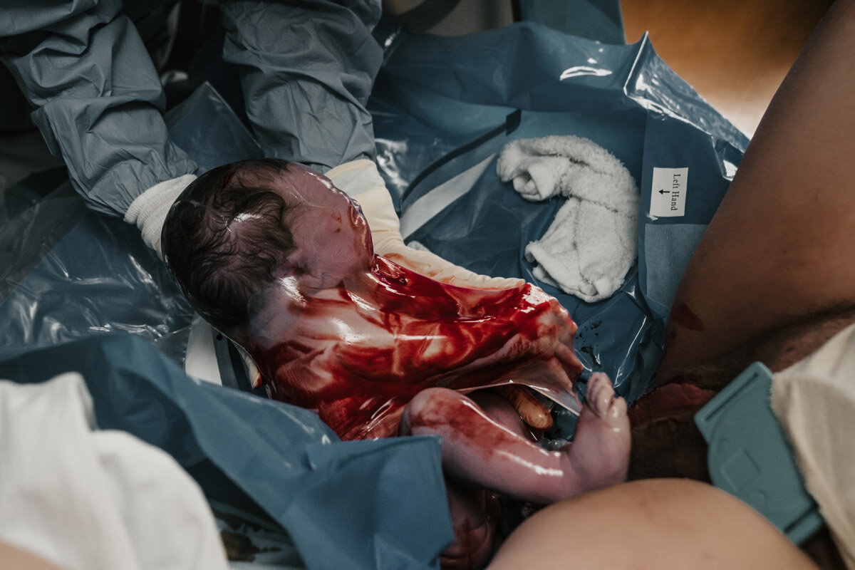 hospital-birth-photography-f-039
