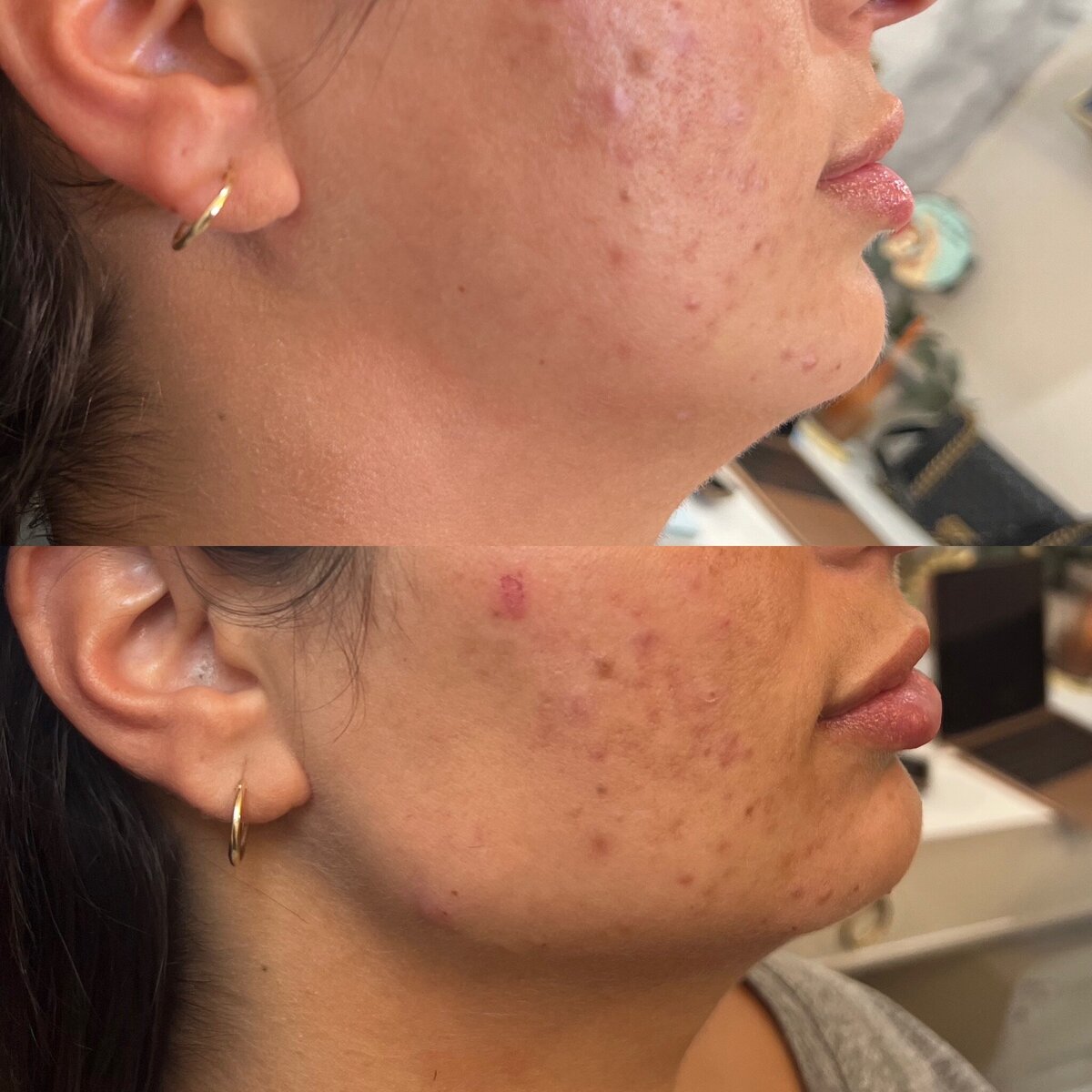 bestnurseinjectorinboston4