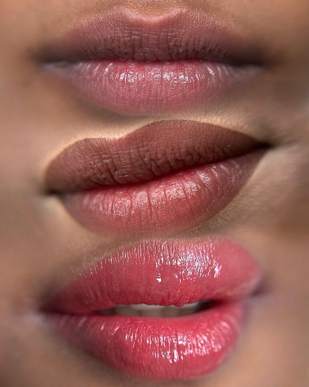 Lips Neutralization Dark Lips Color Correction New York