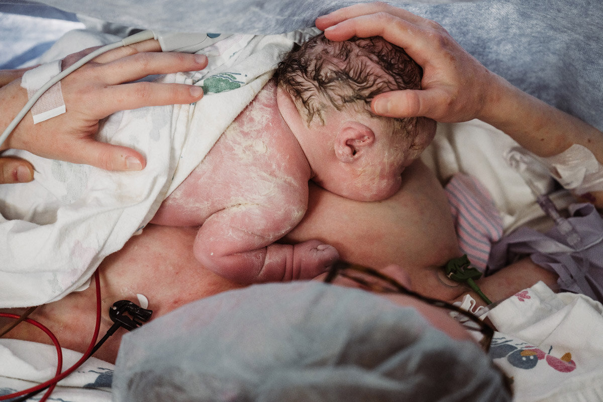 cesarean-birth-photography-natalie-broders-c-029