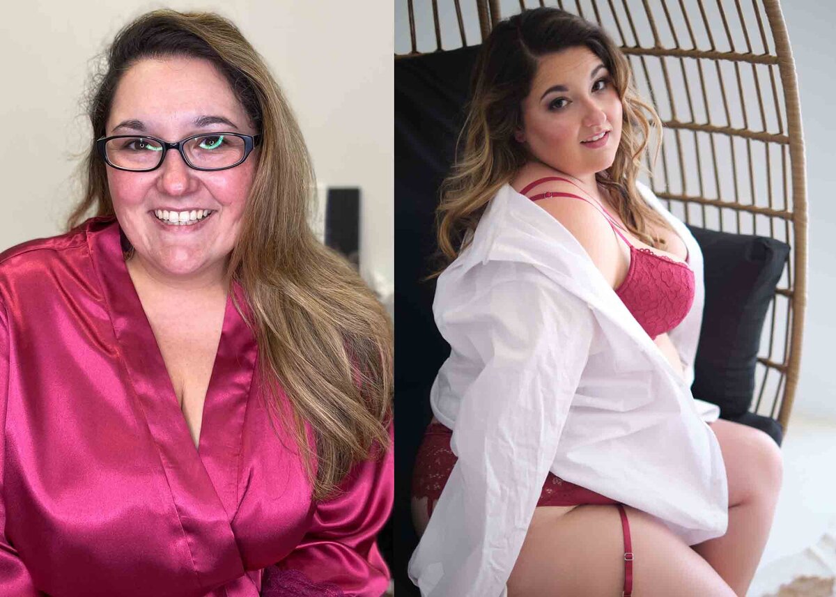before:after