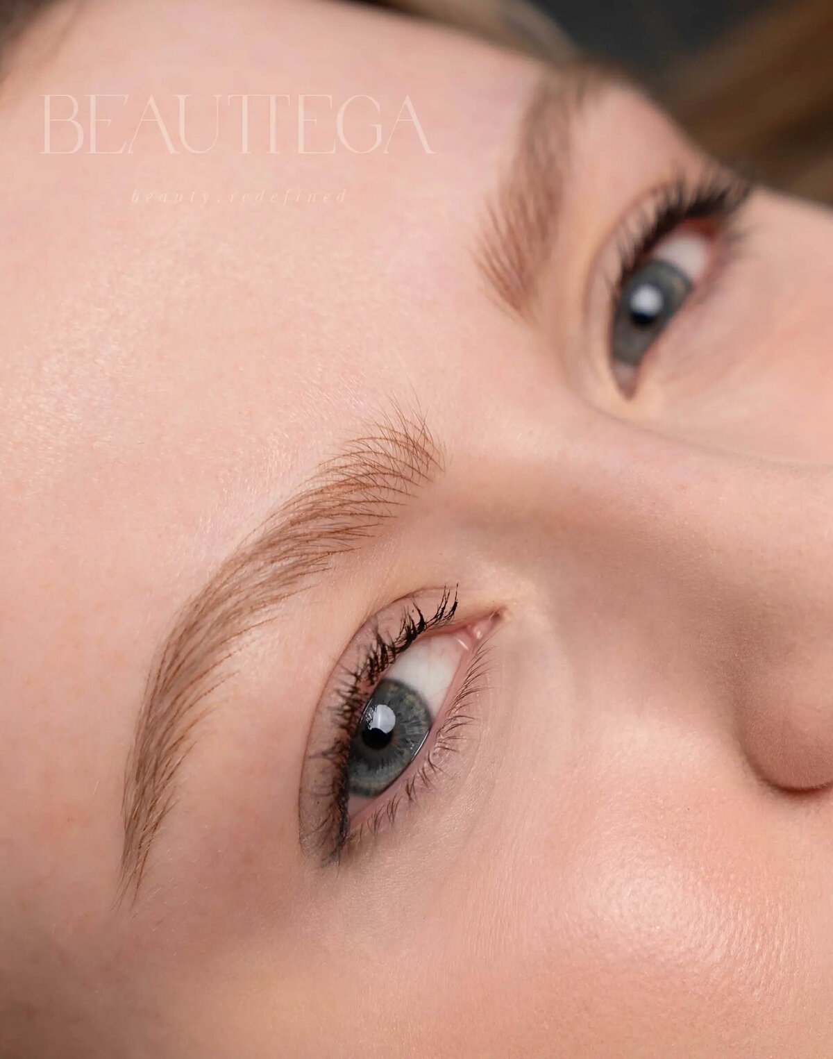 Beauttega E Nano Machine Hair Strokes 5 (C+R)