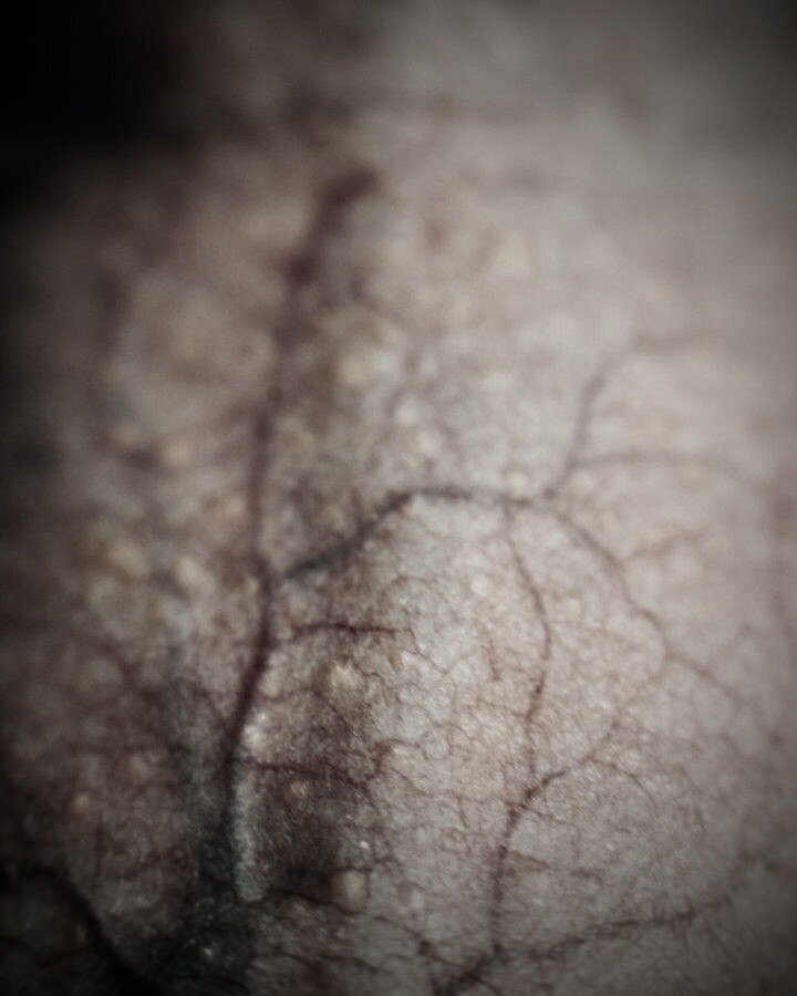 Lashafox on Instagram_ “Come closer  #Lashafox #Georgia #Tbilisi #closeup #comecloser #skin #veins #imaginarymagnitude #boyhill #queer #macro #Photographer #art…”