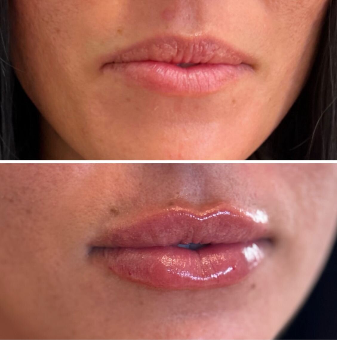 compressed-Lip-Wrinkles- Lip-volume-nd-some-brand-pics-32