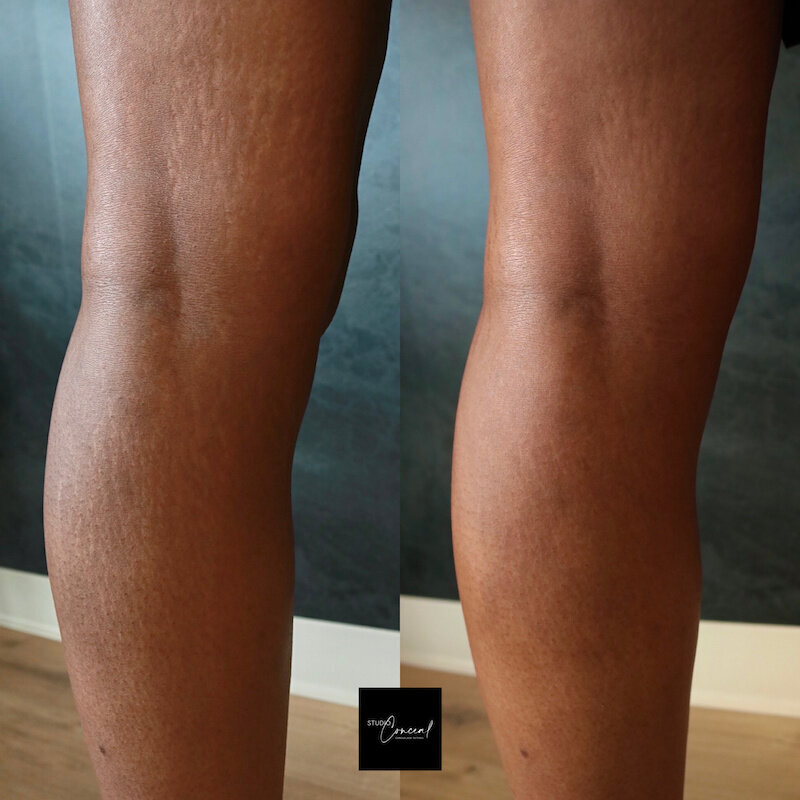black-skin-stretch-mark-cover-up-tattoo-2