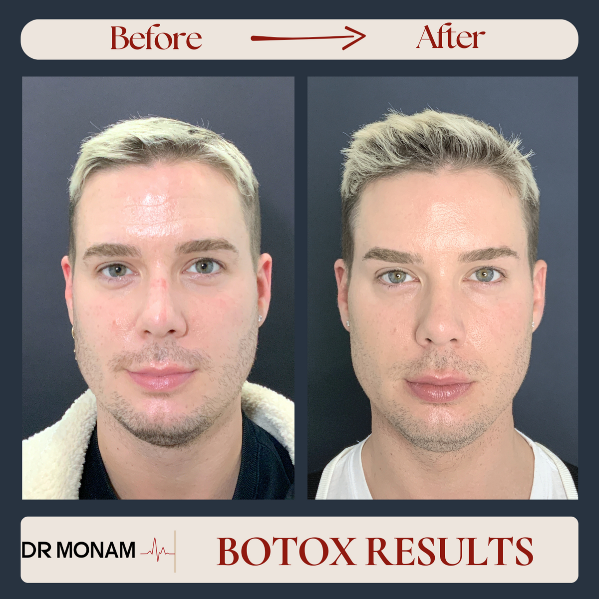 Neutral Before and After Instagram Post-7