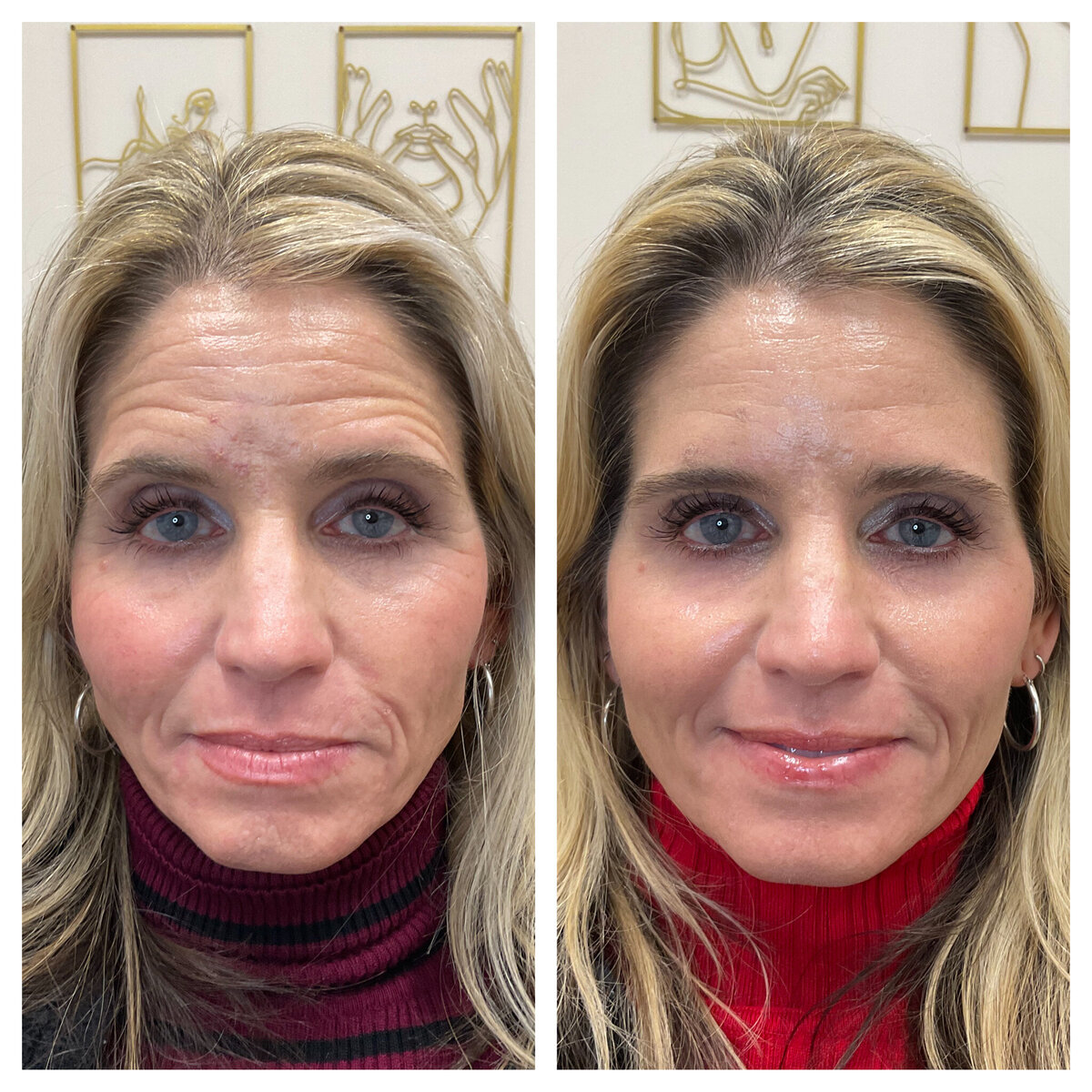 Enhance your natural beauty at true radiance medspa in carlsbad