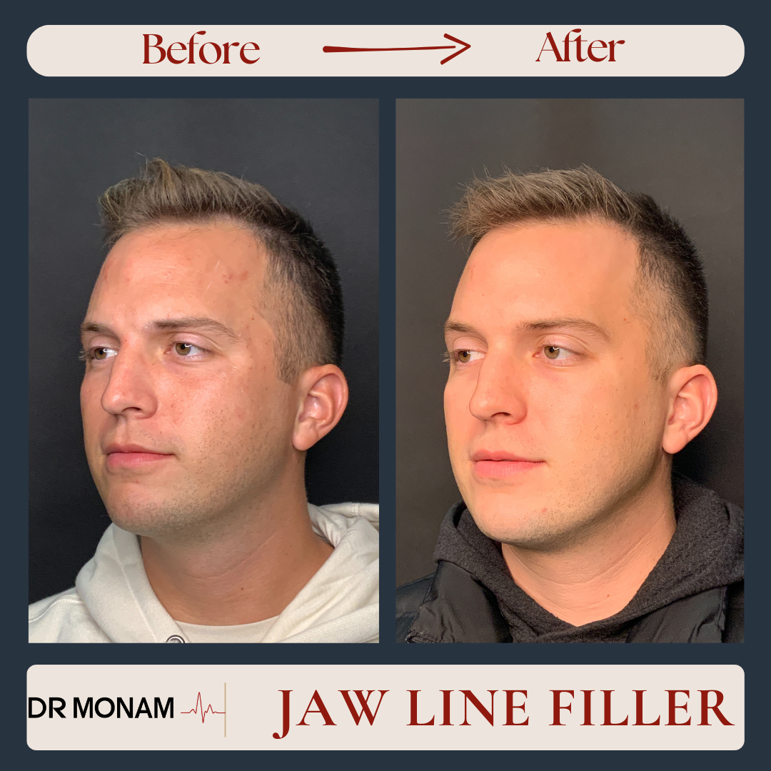 Neutral Before and After Instagram Post-18