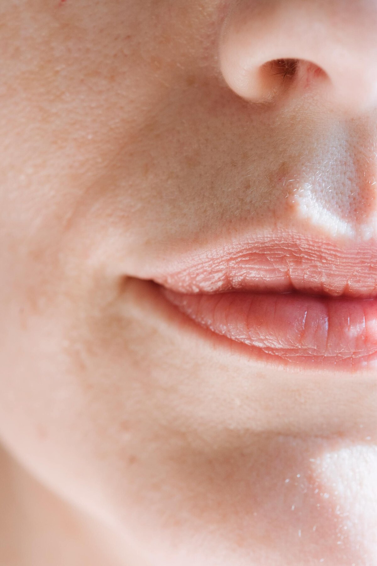 lip-fillers