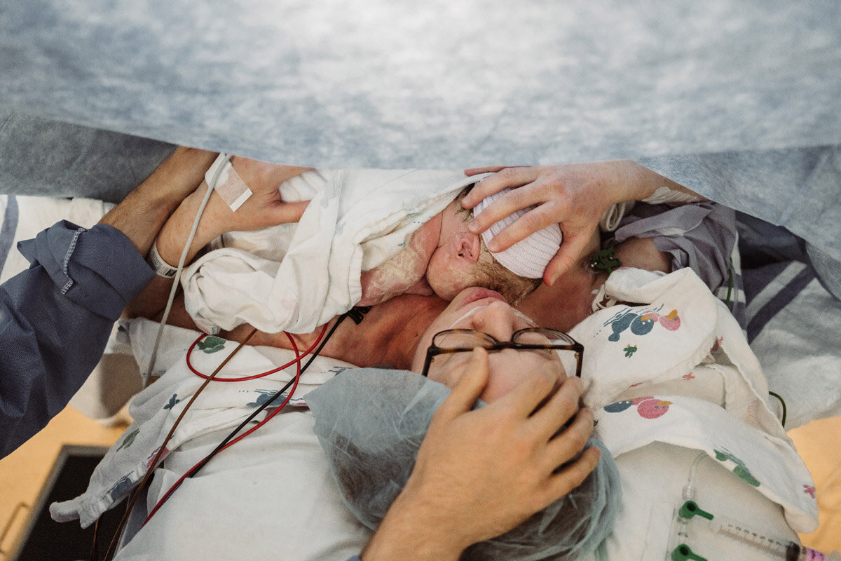 cesarean-birth-photography-natalie-broders-c-027