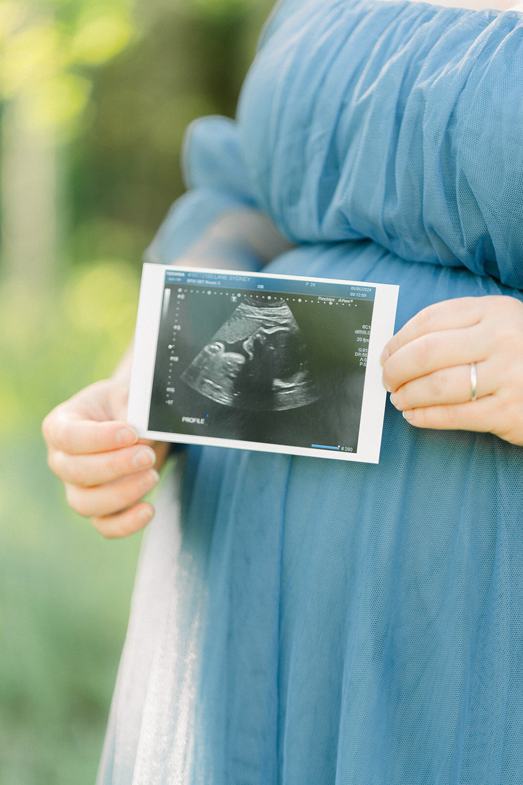 SydneyKyleMaternity2024-6_websize