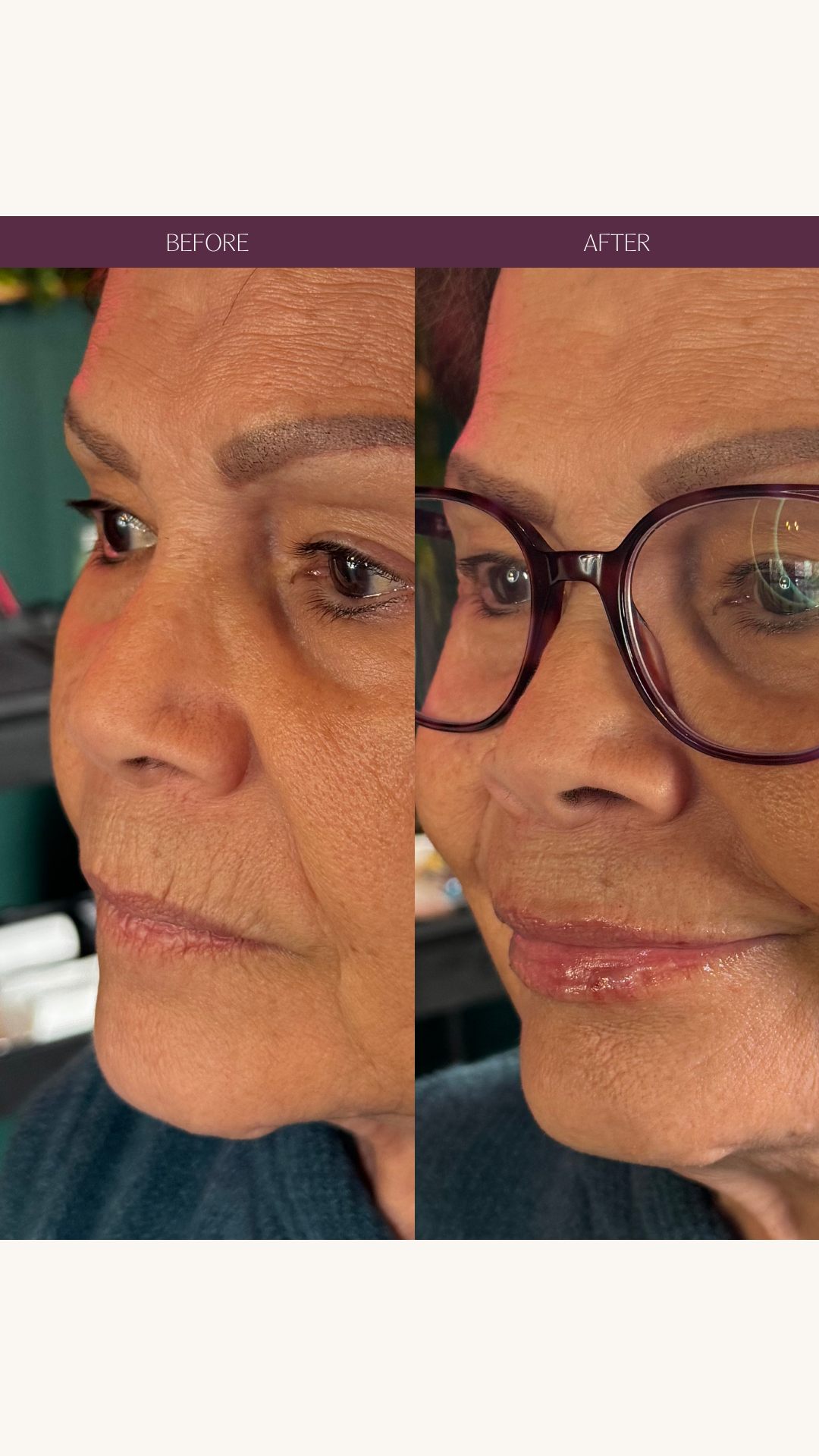 Copy of Before and Afters (Portrait Size).zip - 5 1