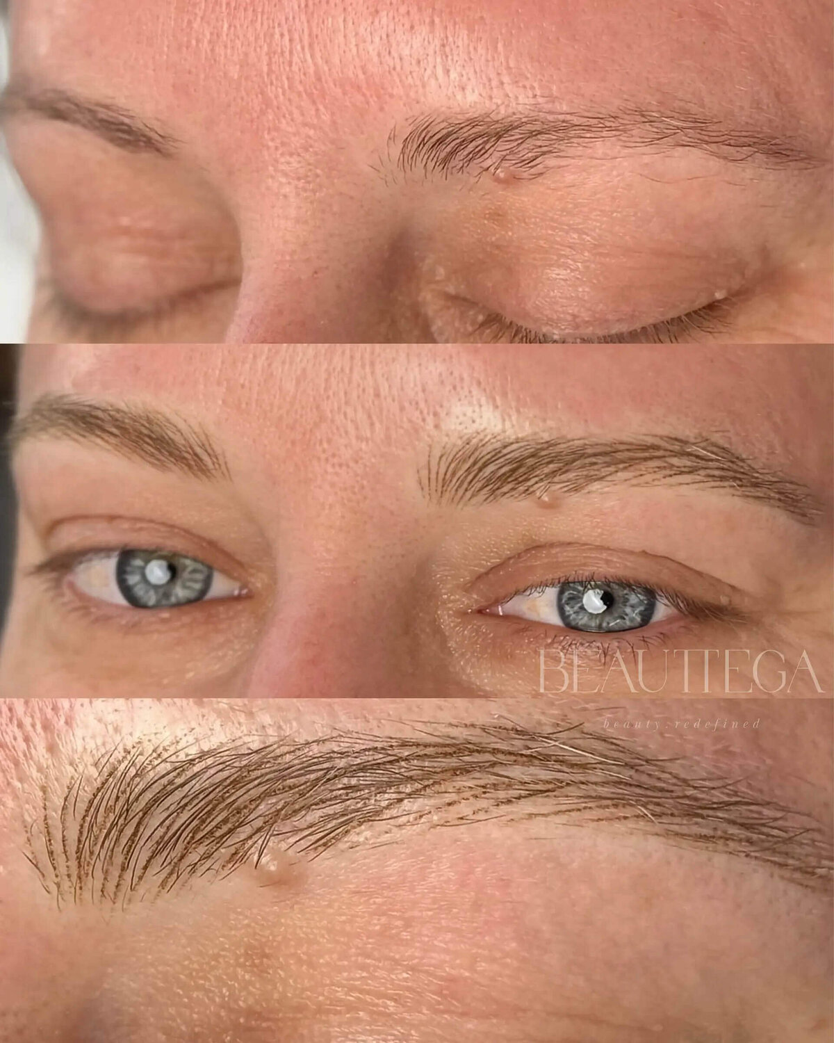 Beauttega C Nano Machine Hair Strokes 26 (C+R)