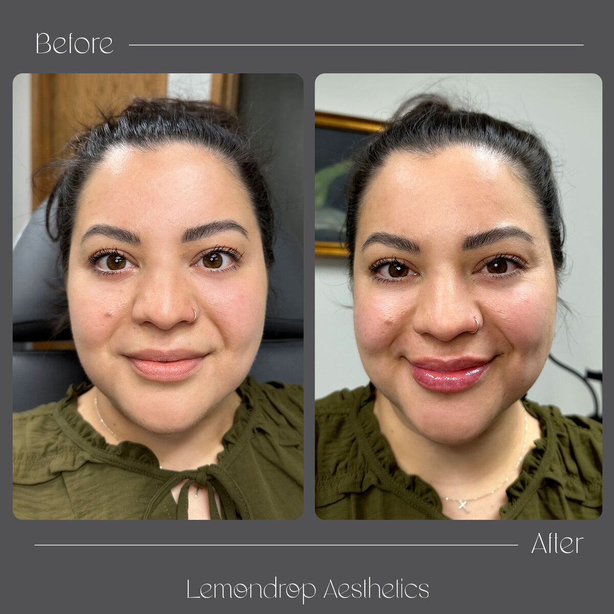 BEFORE-AFTER copy 12