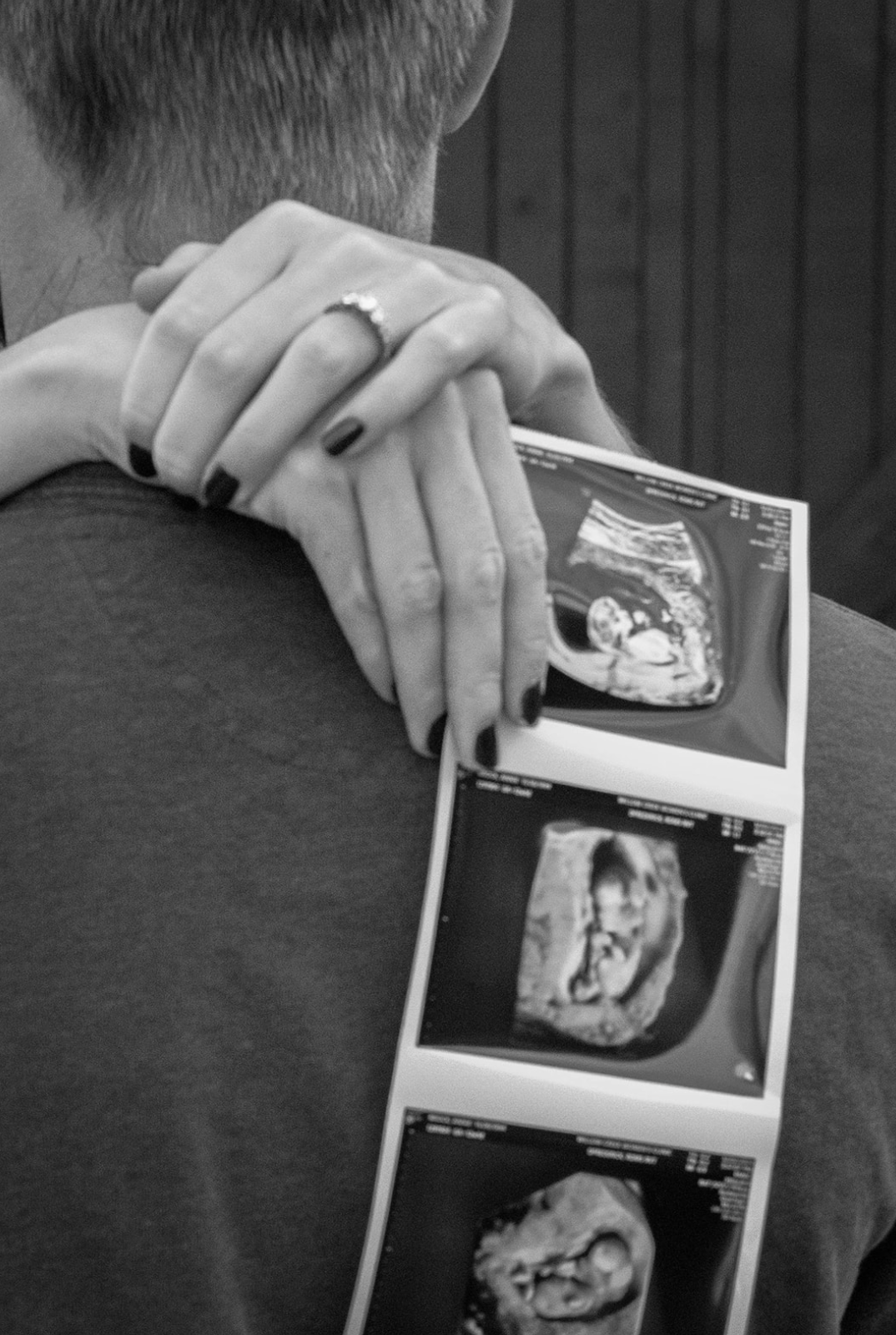 pregnancy-announcement-sonogram-ring