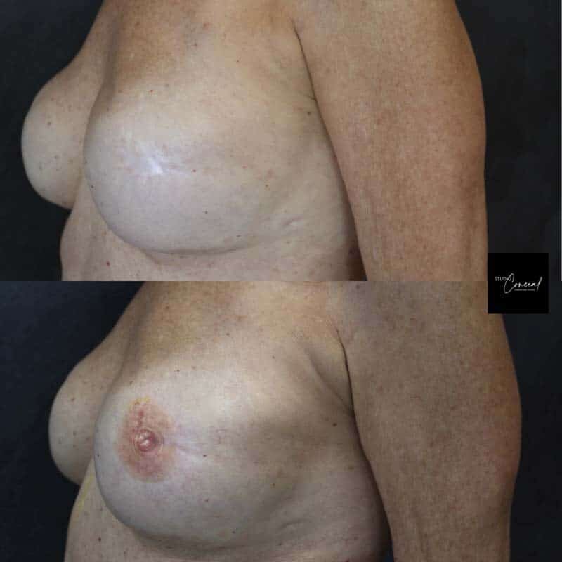 arizona-3d-nipple-tattooist