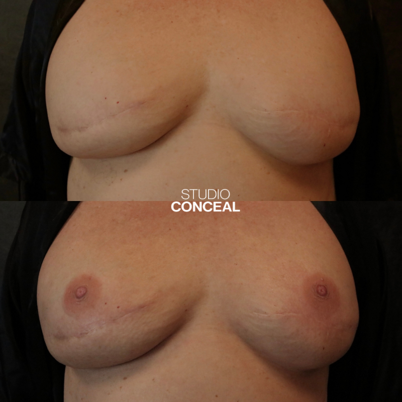 az_3d_areola tattoo_4