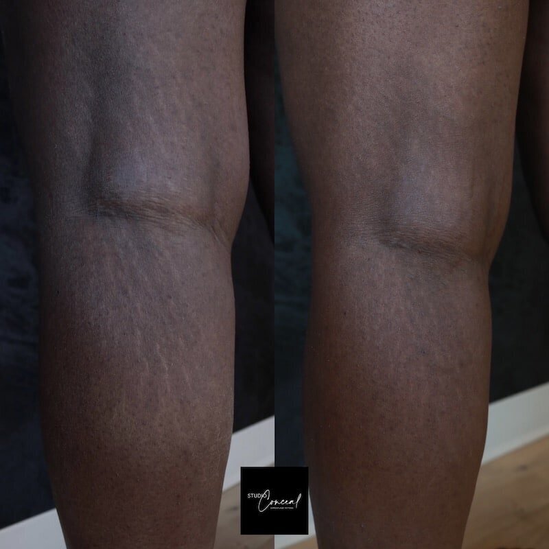 Black-skin-camouflage-2-2