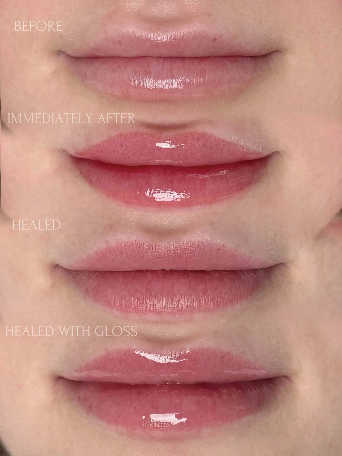 Beauttega E Lip Blush 3 (C+R)