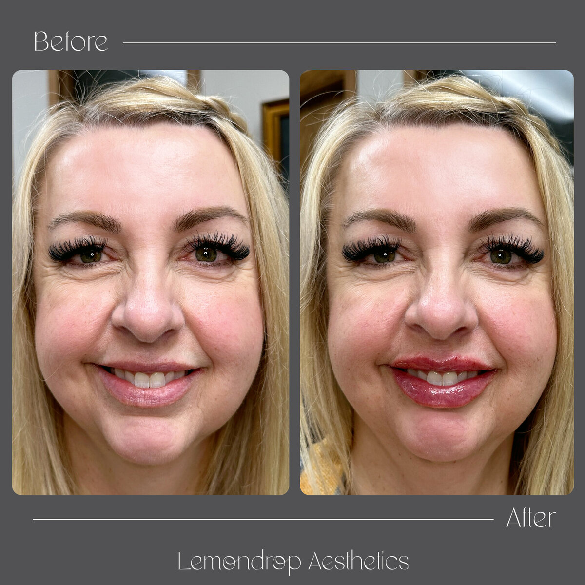 01. BEFORE:AFTER copy
