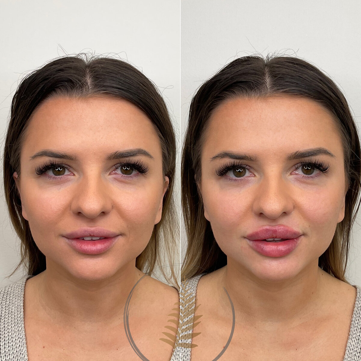 BEFORE:AFTER02 copy 5